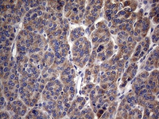 MRPL42 Antibody in Immunohistochemistry (Paraffin) (IHC (P))