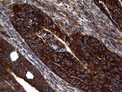 DIRAS2 Antibody in Immunohistochemistry (Paraffin) (IHC (P))