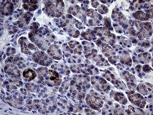 CLIP4 Antibody in Immunohistochemistry (Paraffin) (IHC (P))