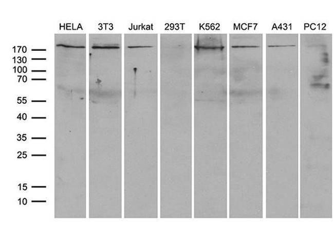 ARHGAP5 Antibody in Western Blot (WB)
