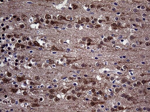 DIRAS2 Antibody in Immunohistochemistry (Paraffin) (IHC (P))