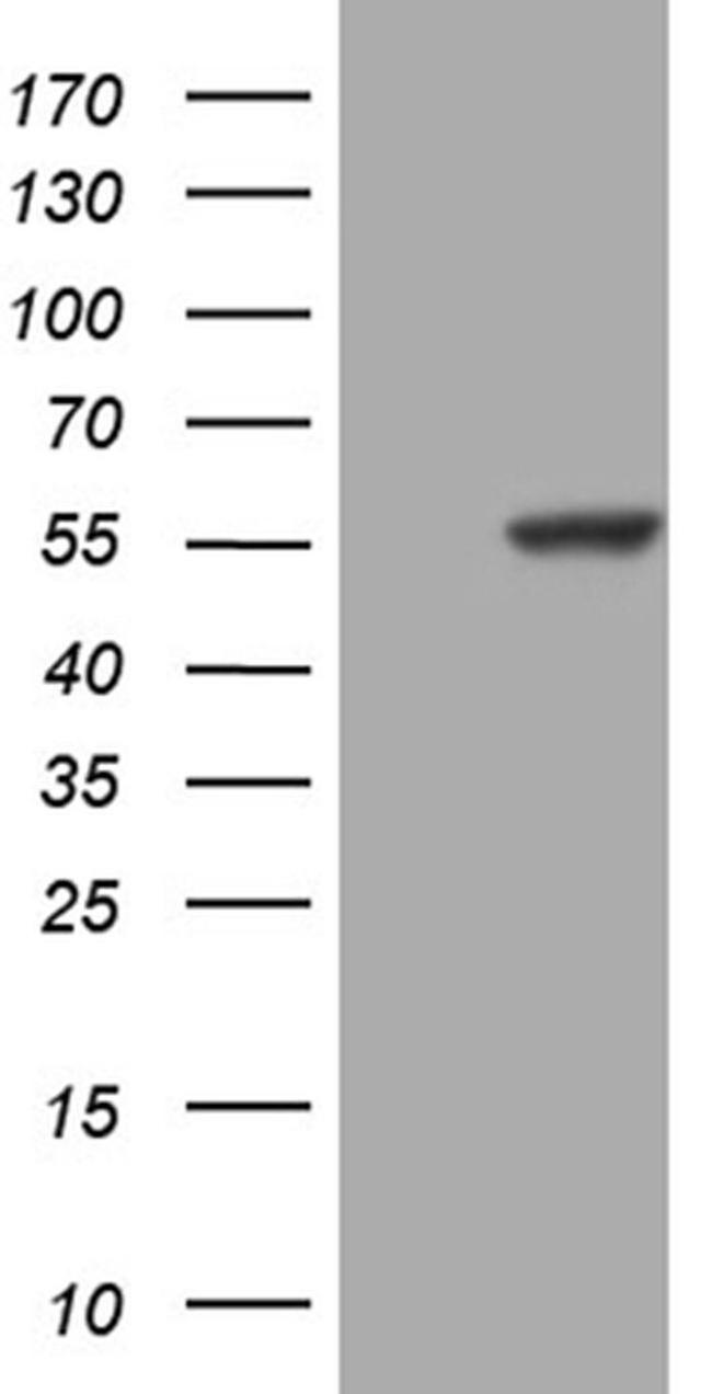 C14orf50 Antibody in Western Blot (WB)
