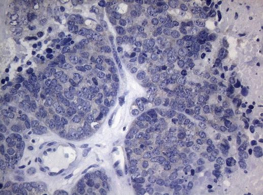 HOXD4 Antibody in Immunohistochemistry (Paraffin) (IHC (P))