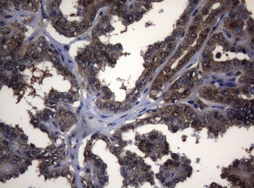 ADH5 Antibody in Immunohistochemistry (Paraffin) (IHC (P))