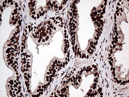 ZRANB2 Antibody in Immunohistochemistry (Paraffin) (IHC (P))