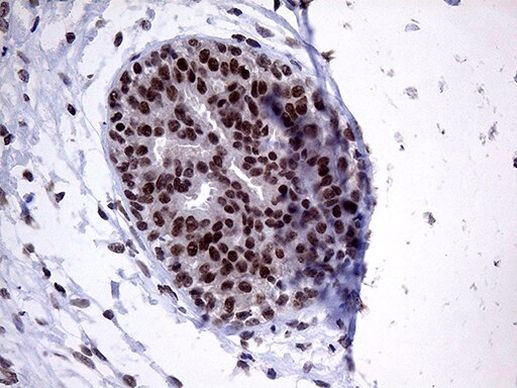 ZNF329 Antibody in Immunohistochemistry (Paraffin) (IHC (P))