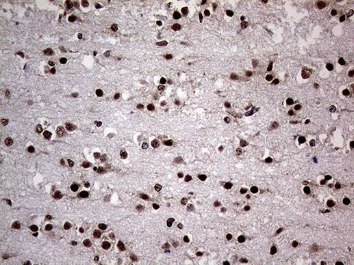 NPAS1 Antibody in Immunohistochemistry (Paraffin) (IHC (P))