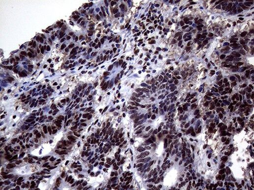 ANP32C Antibody in Immunohistochemistry (Paraffin) (IHC (P))