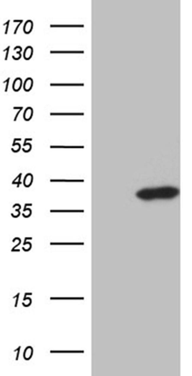 ZMAT4 Antibody in Western Blot (WB)