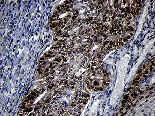 TCF12 Antibody in Immunohistochemistry (Paraffin) (IHC (P))