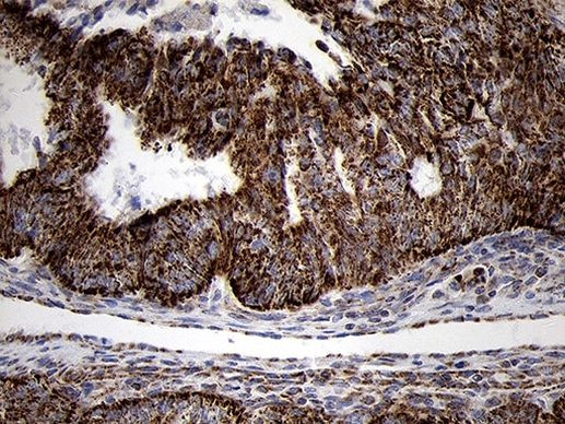 TIMM8A Antibody in Immunohistochemistry (Paraffin) (IHC (P))