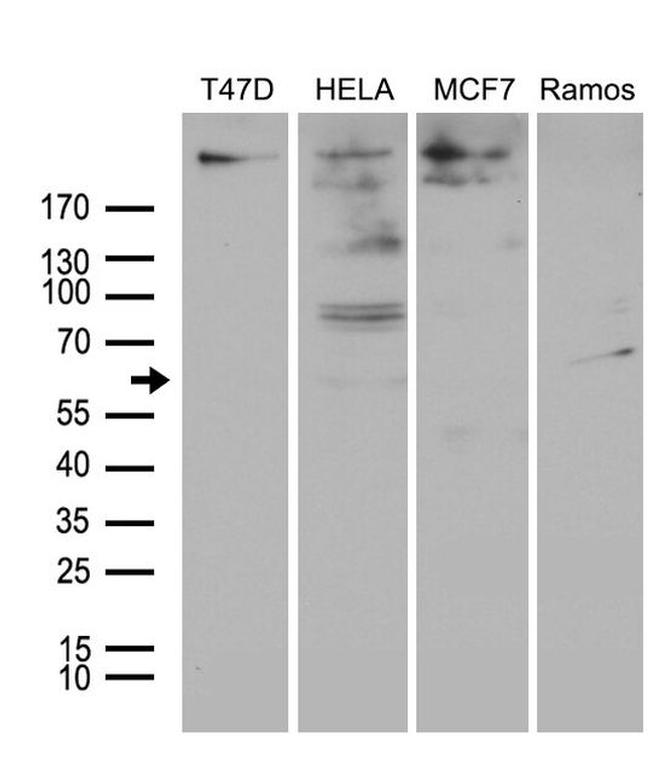 MTA3 Antibody in Western Blot (WB)