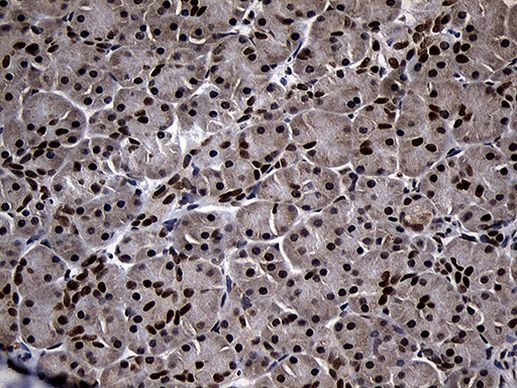 SUPT16H Antibody in Immunohistochemistry (Paraffin) (IHC (P))