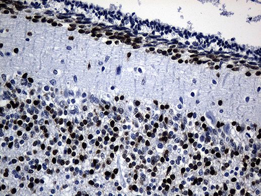 PHF20L1 Antibody in Immunohistochemistry (Paraffin) (IHC (P))