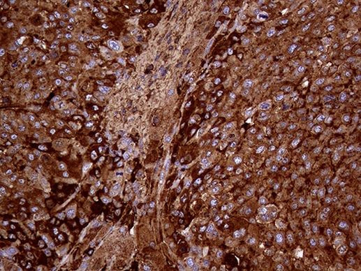 METTL7A Antibody in Immunohistochemistry (Paraffin) (IHC (P))