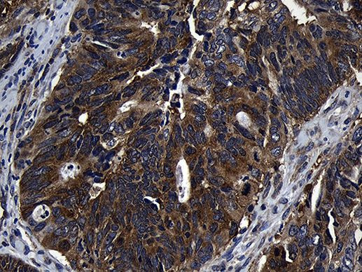 ZFYVE1 Antibody in Immunohistochemistry (Paraffin) (IHC (P))
