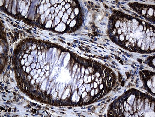 MED28 Antibody in Immunohistochemistry (Paraffin) (IHC (P))