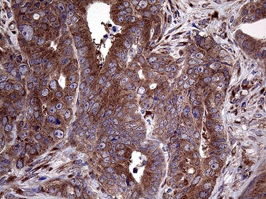 SEC23B Antibody in Immunohistochemistry (Paraffin) (IHC (P))