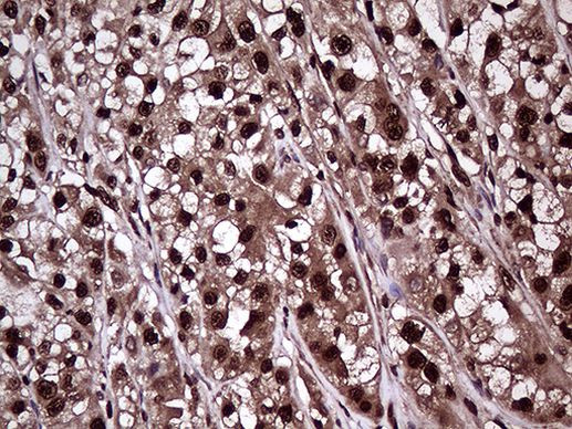 PPP4C Antibody in Immunohistochemistry (Paraffin) (IHC (P))