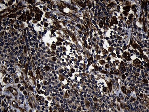 FBXO25 Antibody in Immunohistochemistry (Paraffin) (IHC (P))