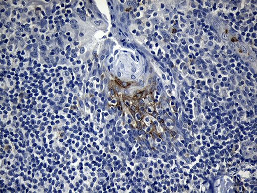 FBXO6 Antibody in Immunohistochemistry (Paraffin) (IHC (P))