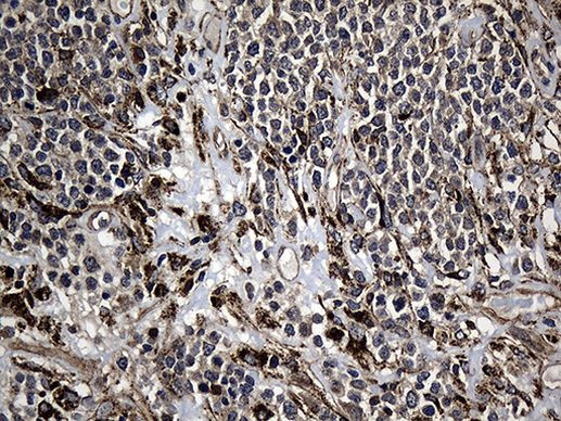 AFAP Antibody in Immunohistochemistry (Paraffin) (IHC (P))