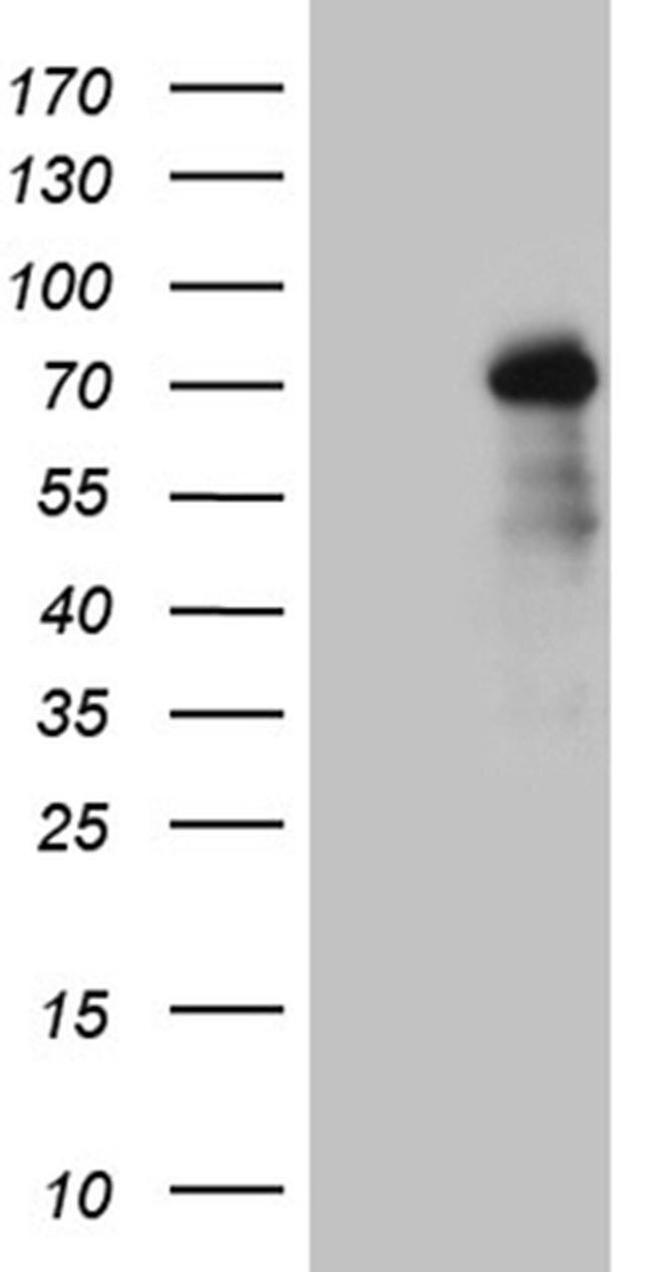 ZNF264 Antibody in Western Blot (WB)