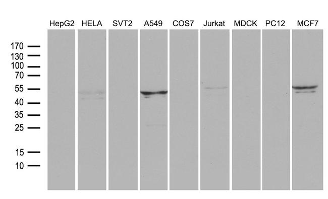 RNF149 Antibody in Western Blot (WB)