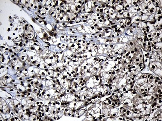 ZNF583 Antibody in Immunohistochemistry (Paraffin) (IHC (P))