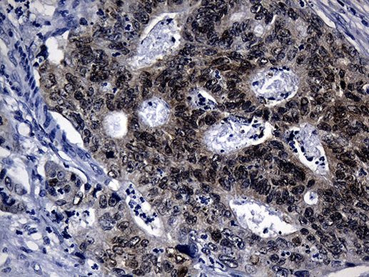 CDX1 Antibody in Immunohistochemistry (Paraffin) (IHC (P))