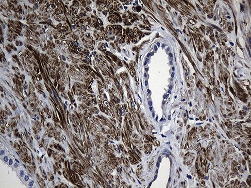 MYL1 Antibody in Immunohistochemistry (Paraffin) (IHC (P))