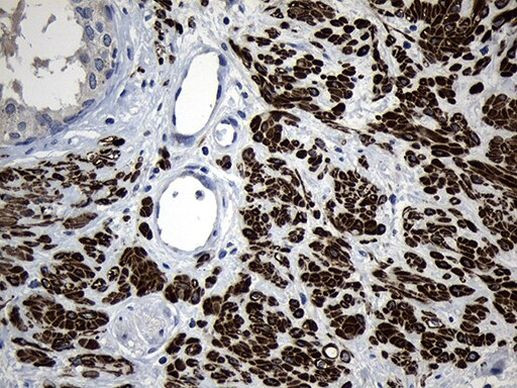 FLJ33360 Antibody in Immunohistochemistry (Paraffin) (IHC (P))