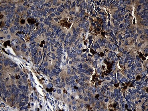 F131C Antibody in Immunohistochemistry (Paraffin) (IHC (P))