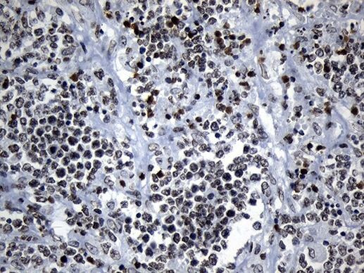 ZNF705D Antibody in Immunohistochemistry (Paraffin) (IHC (P))