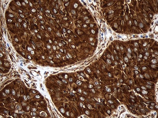 RPL27 Antibody in Immunohistochemistry (Paraffin) (IHC (P))