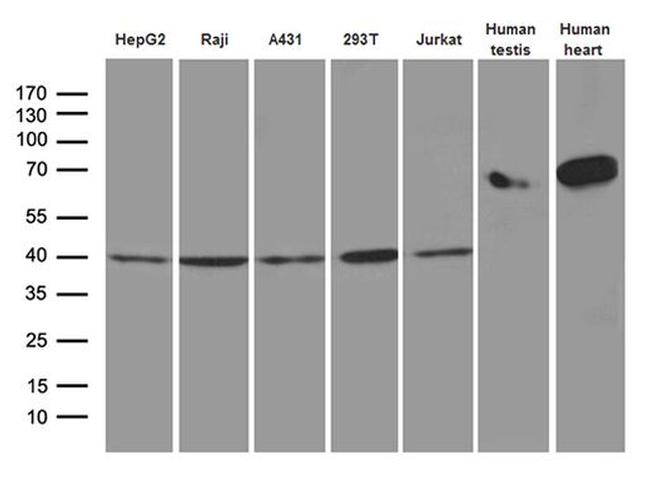 TXNL2 Antibody in Western Blot (WB)