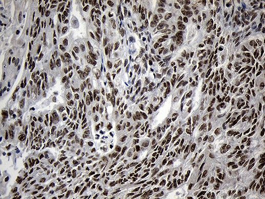 ZNF670 Antibody in Immunohistochemistry (Paraffin) (IHC (P))