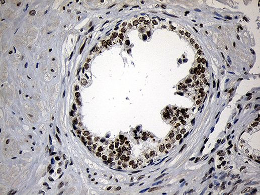 ZNF670 Antibody in Immunohistochemistry (Paraffin) (IHC (P))