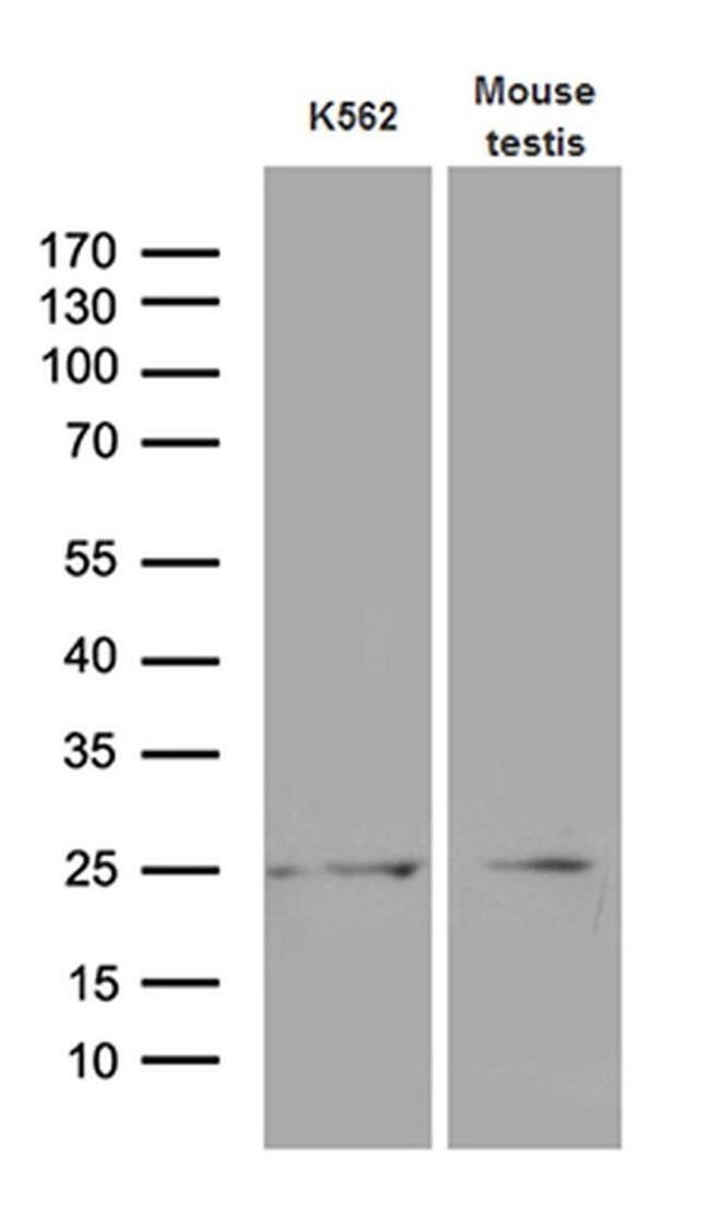 MYL6B Antibody in Western Blot (WB)