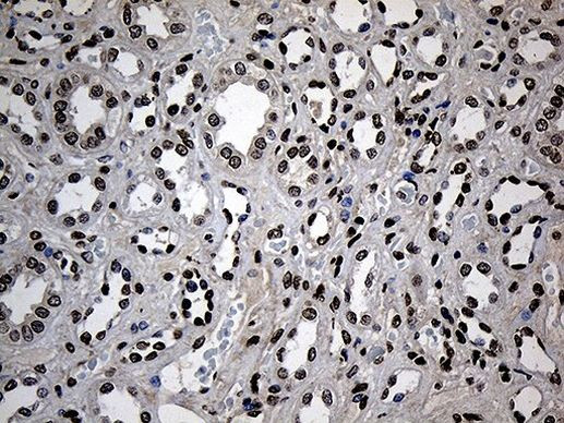 ZNF558 Antibody in Immunohistochemistry (Paraffin) (IHC (P))
