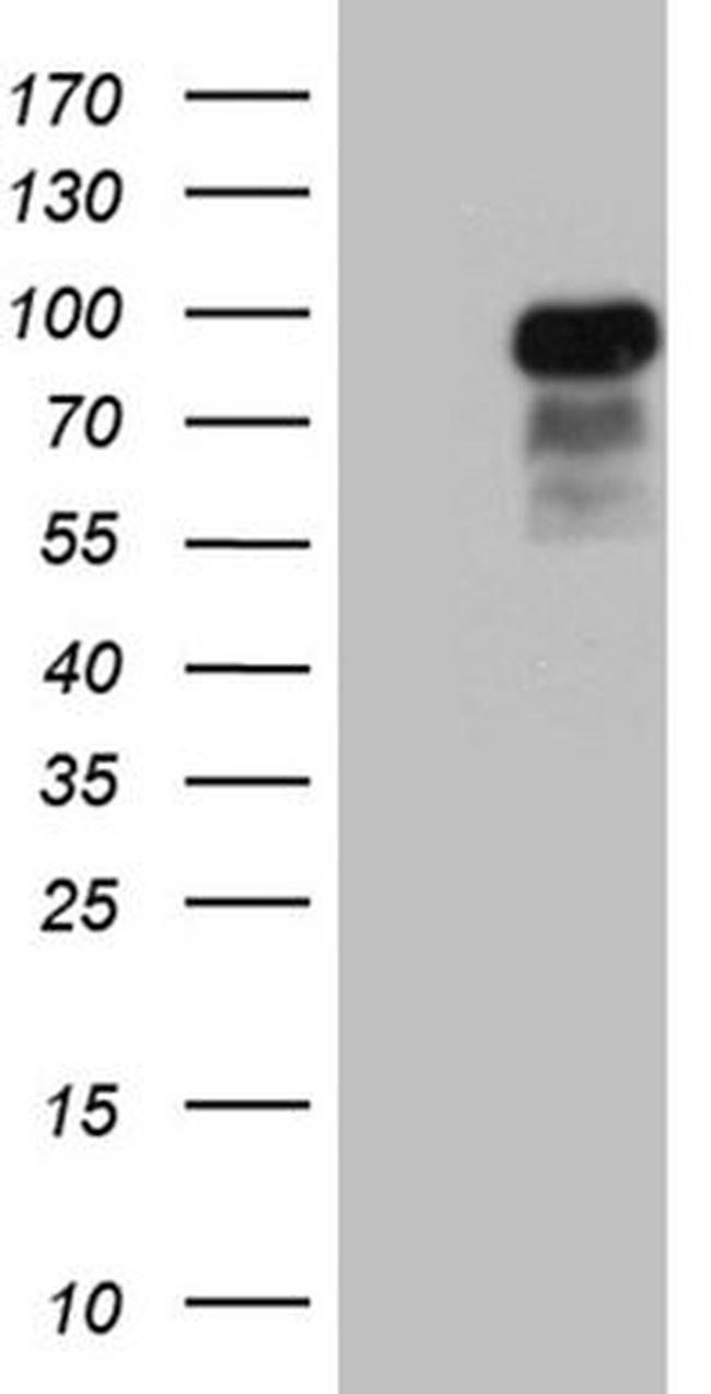 CCDC27 Antibody in Western Blot (WB)
