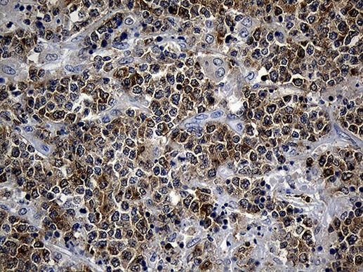 SMAP2 Antibody in Immunohistochemistry (Paraffin) (IHC (P))