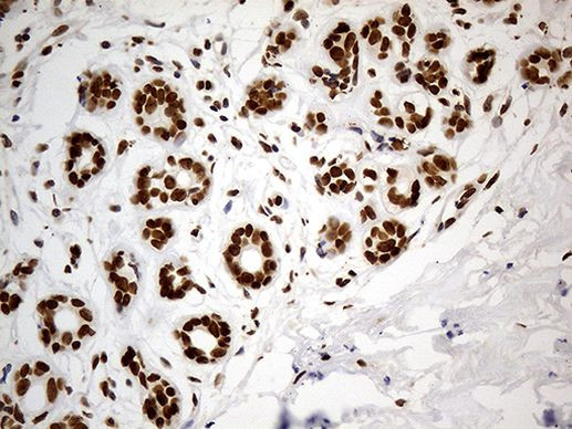 Cdc45L Antibody in Immunohistochemistry (Paraffin) (IHC (P))