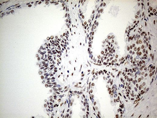 GABPB1 Antibody in Immunohistochemistry (Paraffin) (IHC (P))