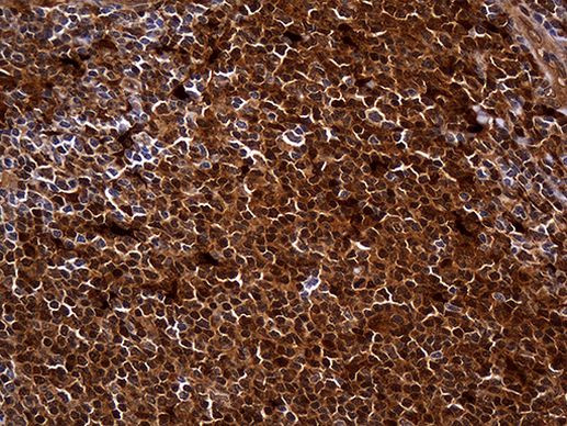 HHLA3 Antibody in Immunohistochemistry (Paraffin) (IHC (P))
