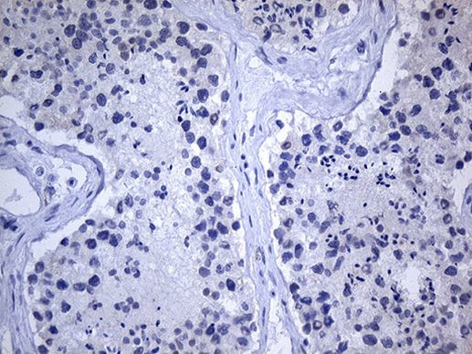 GH2 Antibody in Immunohistochemistry (Paraffin) (IHC (P))
