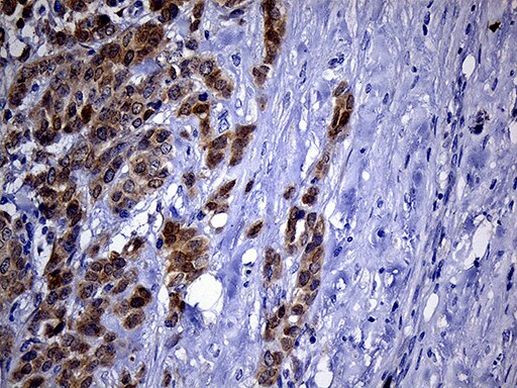 PHYHD1 Antibody in Immunohistochemistry (Paraffin) (IHC (P))