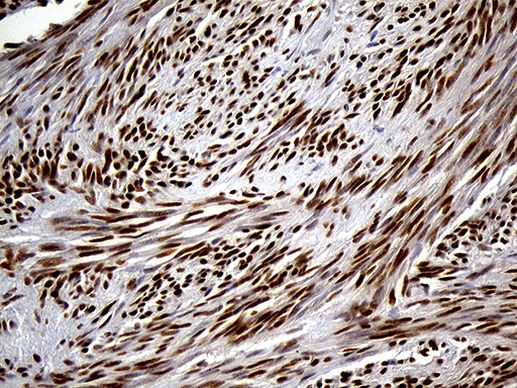 SPANXB1 Antibody in Immunohistochemistry (Paraffin) (IHC (P))