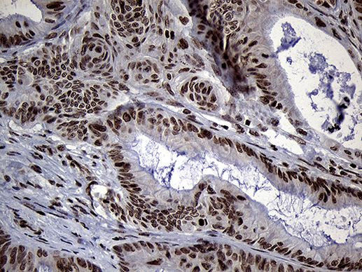 SPANXB1 Antibody in Immunohistochemistry (Paraffin) (IHC (P))
