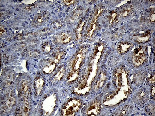HS1BP3 Antibody in Immunohistochemistry (Paraffin) (IHC (P))